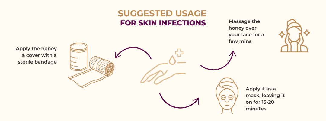 How to use Manuka honey for skin infections, burns and wounds